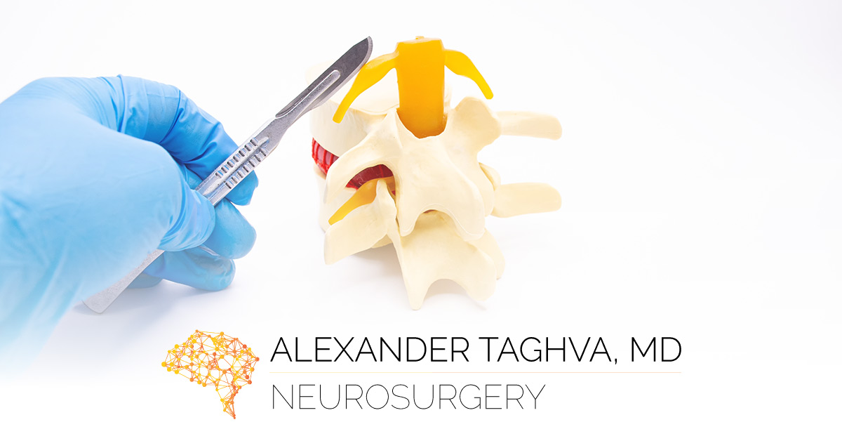 When Spinal Fusion Is Necessary | Dr. Alexander Taghva | Orange