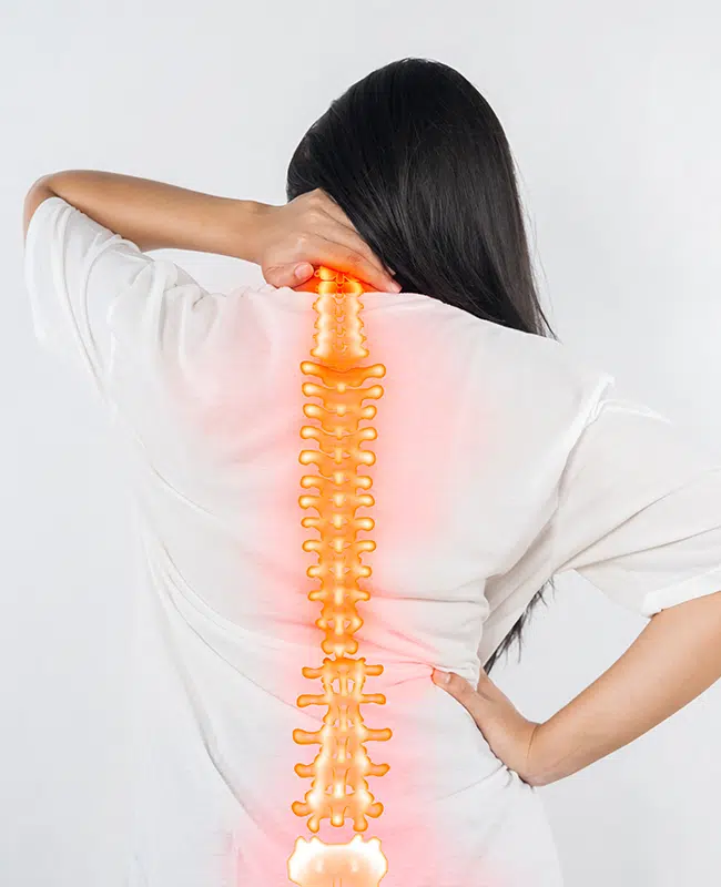 Revision Spine Surgery