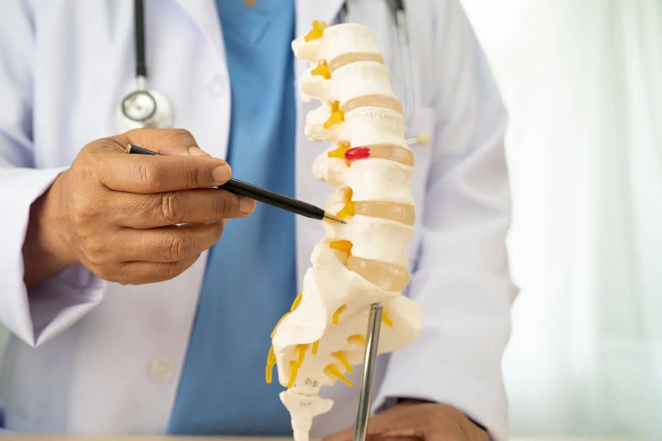 Physician demonstrating spine model to explain basivertebral nerve ablation procedure for chronic low back pain treatment